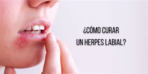 ¿Cuál es la mejor crema para herpes labial? | FARMACÉUTICO ONLINE