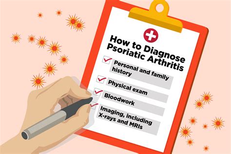Psoriatic Arthritis Diagnosis: How Doctors Diagnose Psoriatic Arthritis