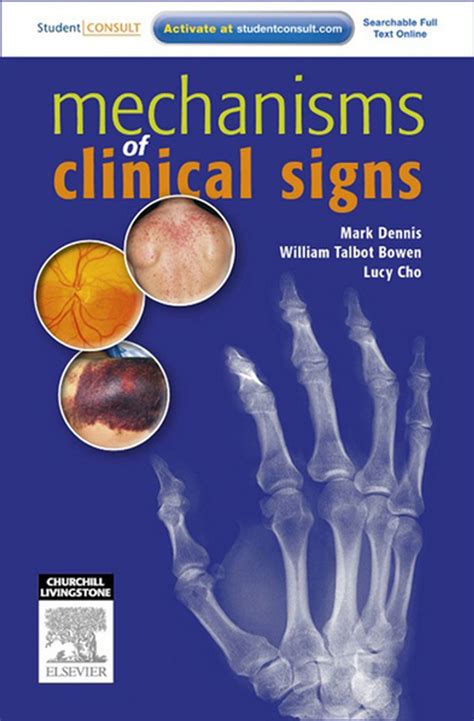 Mechanisms of Clinical Signs - E-Book eBook by Mark Dennis, MBBS (Honours) - EPUB | Rakuten Kobo ...