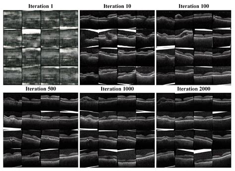 Transfer Learning and Interpretable Analysis-Based Quality Assessment ...