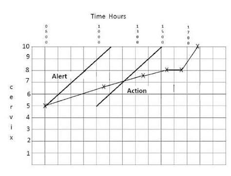 Image result for Partogram Examples