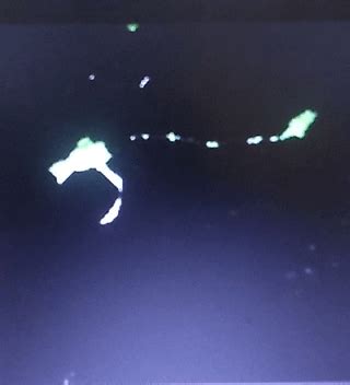 Image result for Red Blood Problem Blob Numjacks