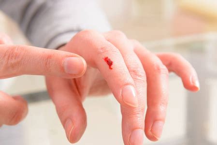 手指血图片-手指血素材-手指血插画-摄图新视界