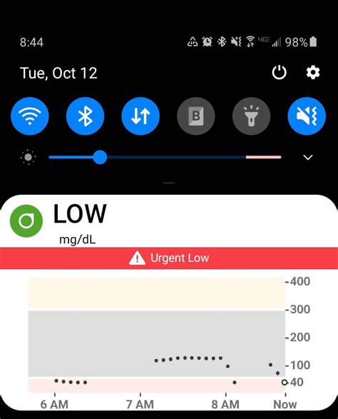 Image result for Dexcom Keeps Loosing Sensor Signal