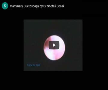 Endoscopy (Ductoscopy) - Breast Care Clinic