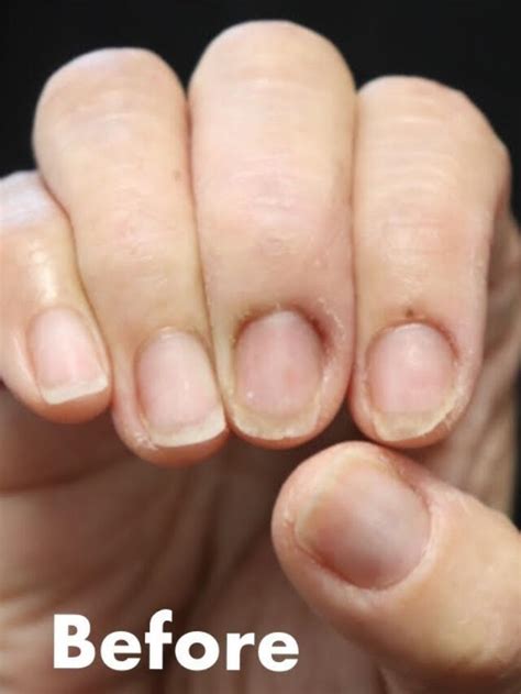 Image result for Calcium Buildup Signs