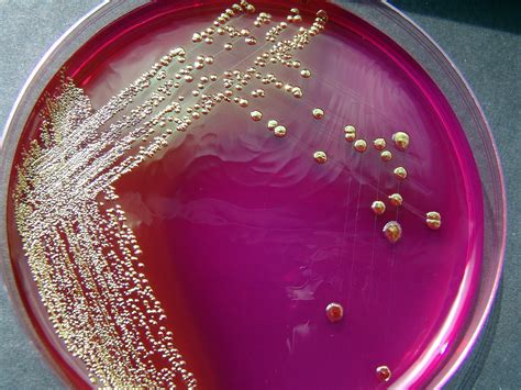 Free Escherichia coli Stock Photo - FreeImages.com