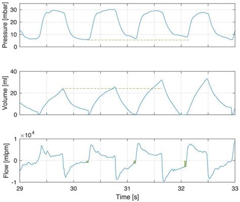Incomplete Exhalation during Resuscitation—Theoretical Review and ...