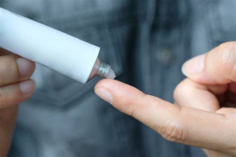 Mometasone Furoate Salicylic Acid Ointment Manufacturer, Supplier from Una