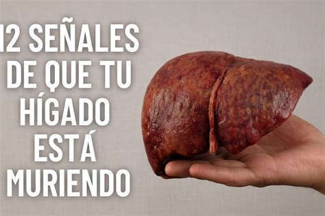 Sintomas De Higado Enfermo