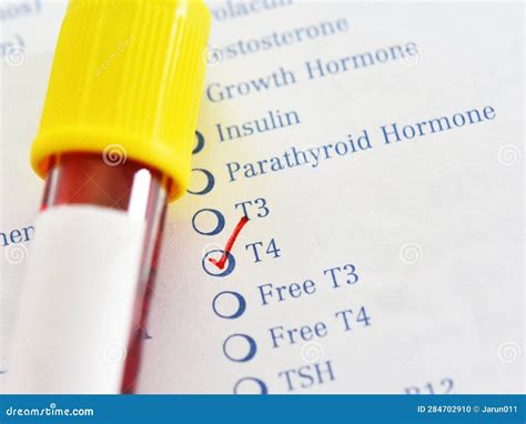 Blood Sample Tube for Thyroxine (T4) Test Stock Photo - Image of hypothalamus, analyzing: 284702910