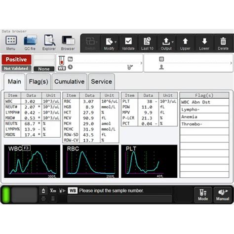 Hematology Analyzer - Sysmex XP-300 Automated Hematology Analyzer ...