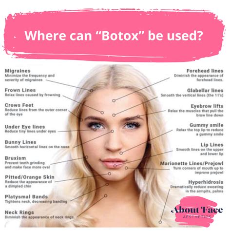 Top 10 Most Popular Facial Botox Injection Sites – Healthtost