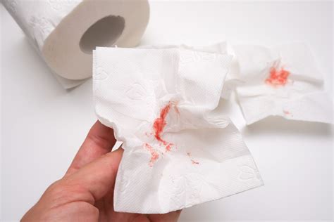 Implantation Bleeding On Toilet Paper A Photo Of Used Bloody Toilet