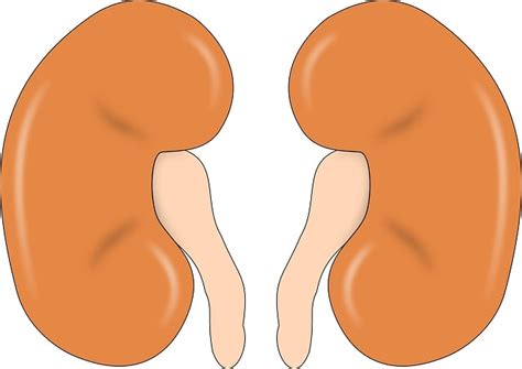 Bosniak Cyst/Renal Cyst/Kidney Cyst: Risk of Cancer or Not - Sidhuz Vlog