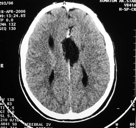 Image result for Scanner Cerebral Avec Injection Diode