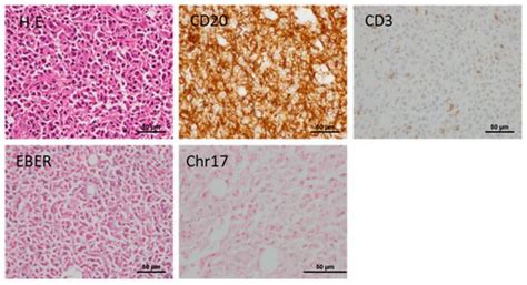 Establishment of Novel Gastric Cancer Patient-Derived Xenografts and ...