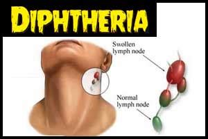 Delhi Diphtheria deaths: Mayor suspends MS of Maharishi Valmiki ...