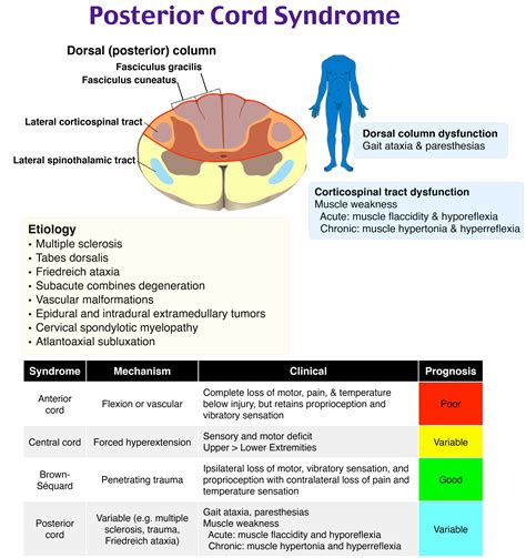 EM@3AM: Thoracic and Lumbar Spine Trauma - emDocs