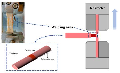 Temperature Distribution of Vessel Tissue by High Frequency Electric ...