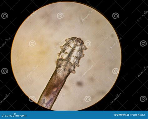 Demodex Folliculorum - Parasitic Mite on the Eyelashes of a Human Eye Stock Image - Image of ...