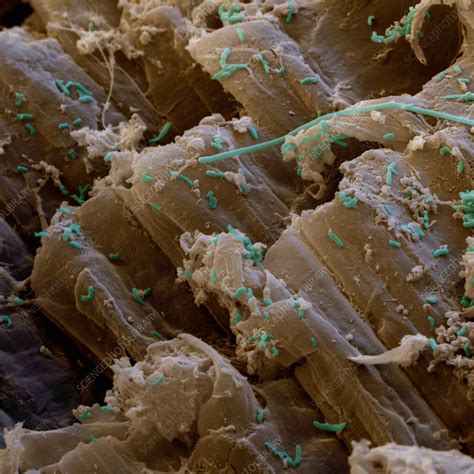 Acetobacter Isolation Process Image 的图像结果