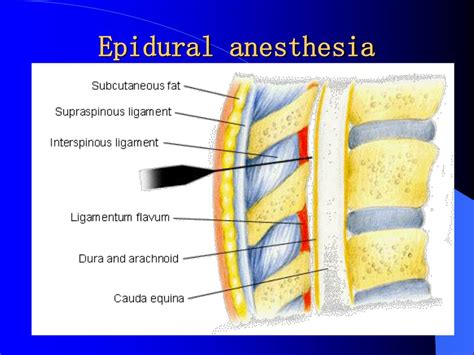 Surface Anesthesia 的图像结果