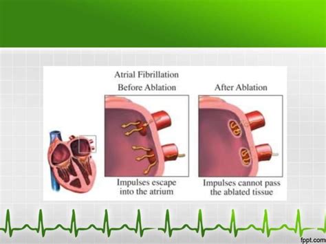 Image result for Delta Modulation Kit Connection