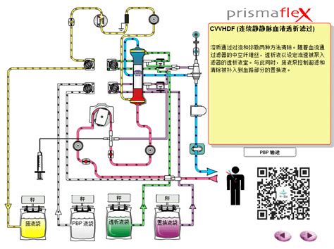 CRRT Recirculation 的图像结果