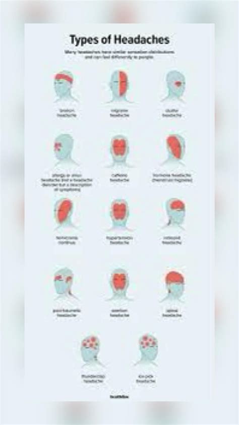 Ice pick headaches causes and treatment – Artofit