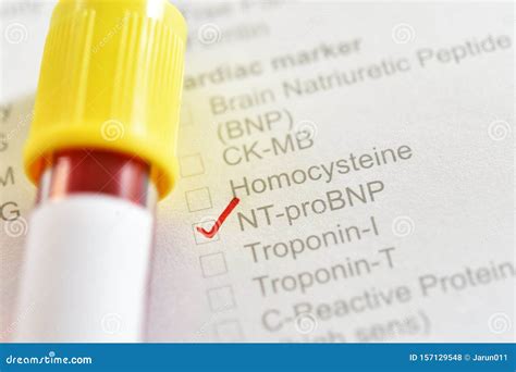 What Is A Nt Pro Bnp Blood Test at Savannah Holroyd blog