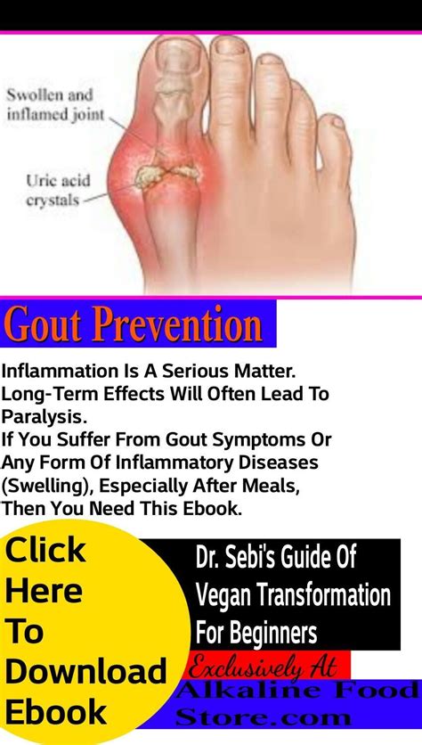 Pin on Gout