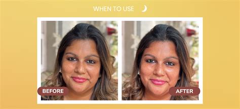 BiE Halo Saffron Oil for Pigmentation | Free Face Massager - beautybybie