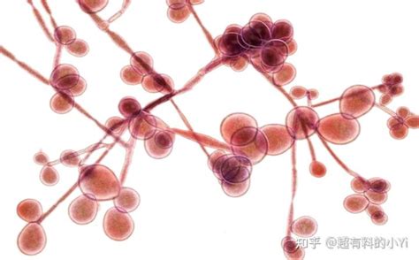 美国爆发“超级真菌” 中国已确诊有感染病例|念珠菌|真菌|病例_新浪新闻