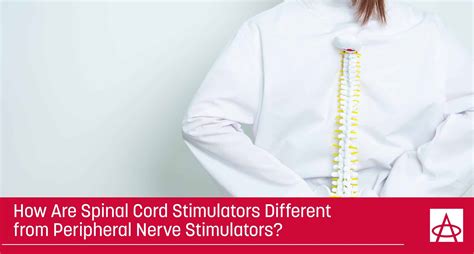 Spinal Cord Stimulators vs. Peripheral Nerve Stimulators