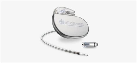 Image result for Pacemaker X-ray Algorithm
