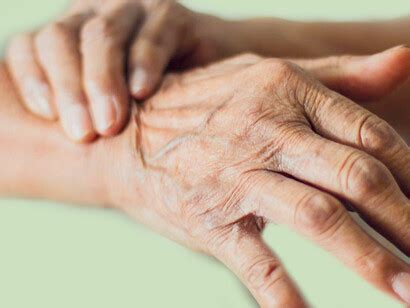 ¿Parkinsonismo o enfermedad de Parkinson? | Meer