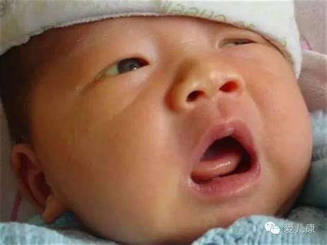 新生儿黄疸和空气污染有什么关系 哪些宝宝容易发生黄疸 _八宝网