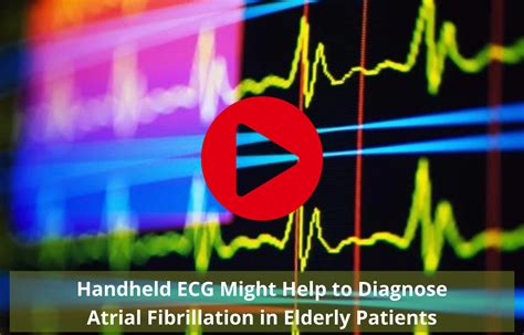 Handheld ECG Might Help to Diagnose Atrial Fibrillation in Elderly Patients