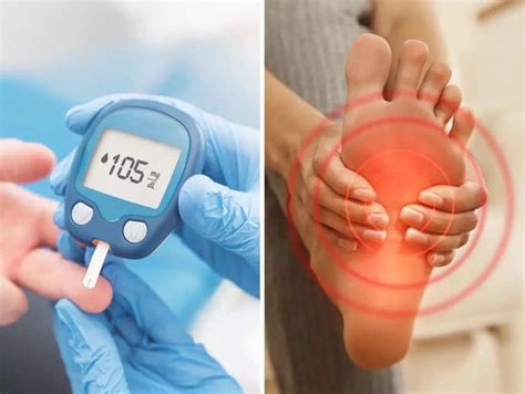 High blood sugar: Untreated diabetic foot ulcers can lead to ...