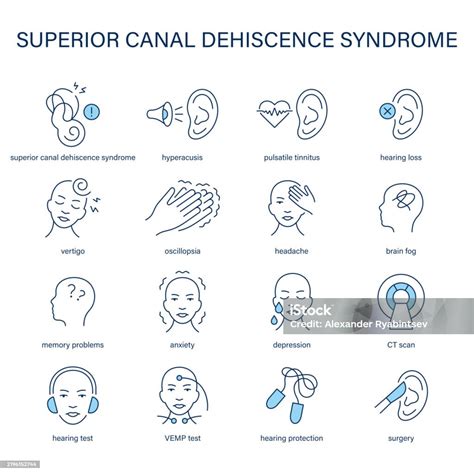 Superior Canal Dehiscence Syndrome 증상 진단 및 치료 벡터 아이콘 세트 브레인 포그에 대한 스톡 벡터 아트 및 기타 이미지 - iStock
