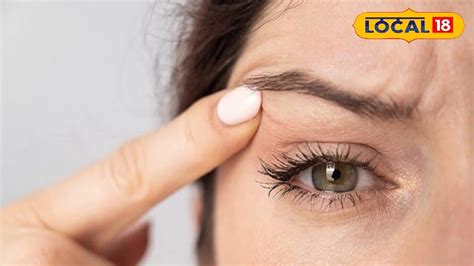 Eye Twitching:ঘন ঘন চোখের পাতা কাঁপছে? সাবধান! কুসংস্কার নয়, নেপথ্যের ...