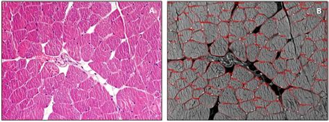 Morphological and Functional Aspects of Human Skeletal Muscle