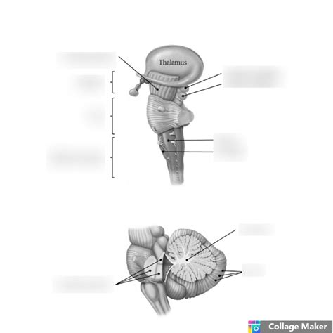 Brain 的图像结果