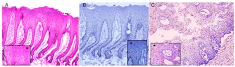 Molecular Diagnosis of Cetacean Morbillivirus in Beaked Whales Stranded ...