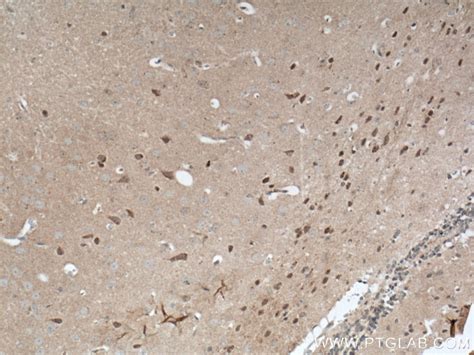 CDC6 antibody (11640-1-AP) | Proteintech