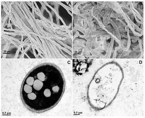 Antifungal Effects of Rhizospheric Bacillus Species Against Bayberry ...