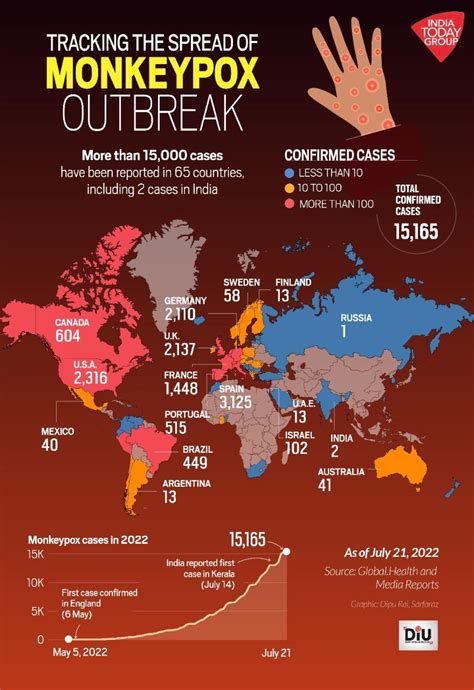 Monkeypox: WHO again considers declaring virus a global emergency ...