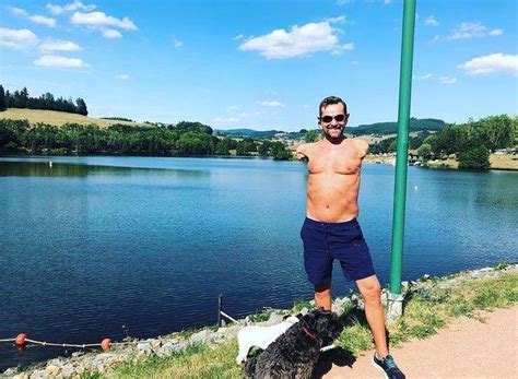 Hito científico: un islandés recibió el primer trasplante de brazos de ...