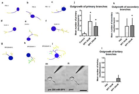 Unleashing Intrinsic Growth Pathways in Regenerating Peripheral Neurons